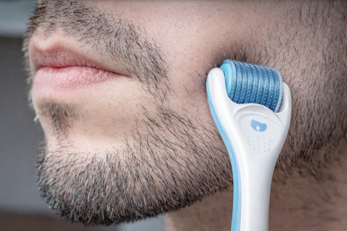 Derma Roller Follicare — Complément idéal à votre cure repousse